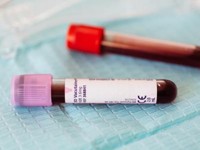 Groupe sanguin – Au delà des lettres et des&nbsp;&lsquo;+&rsquo;